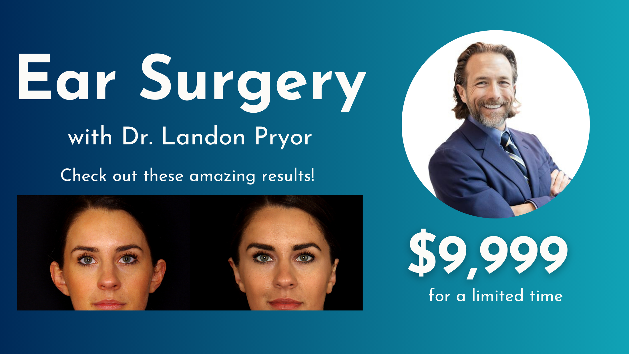 otoplasty dr pryor special