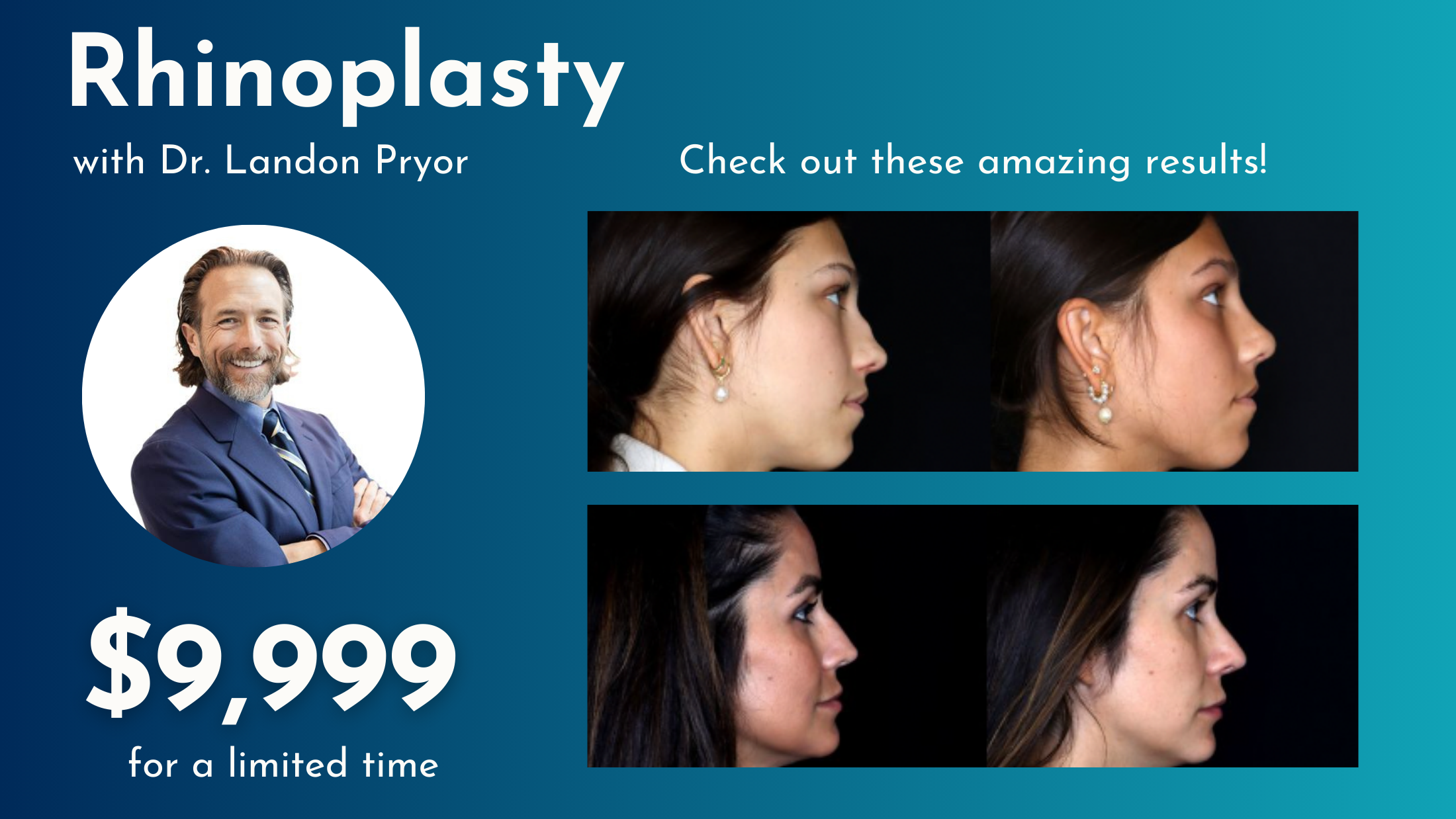 rhinoplasty dr pryor special